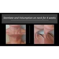 Thumbnail for Volumption-All Natural Organic Plumping Serum, Use On Face, Neck And Around Lips. Adds Volume To Subcutaneous Fat-Helping Diminish Wrinkles, Fine Lines Shallow Contours And Skin Folds.