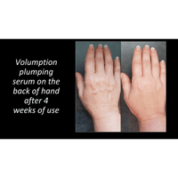 Thumbnail for Volumption-All Natural Organic Plumping Serum, Use On Face, Neck And Around Lips. Adds Volume To Subcutaneous Fat-Helping Diminish Wrinkles, Fine Lines Shallow Contours And Skin Folds.
