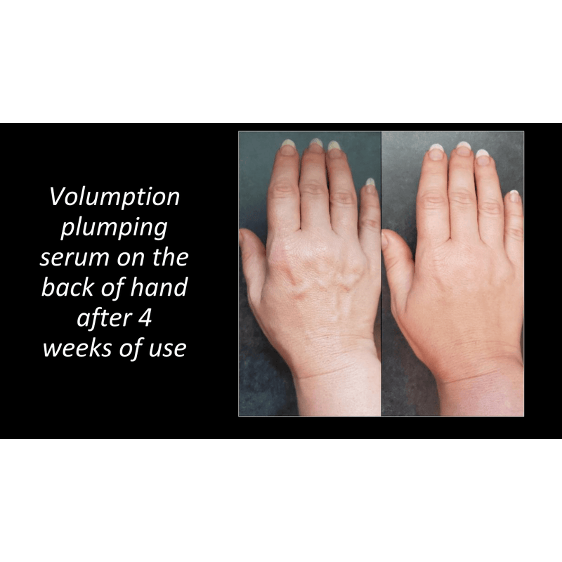 Volumption-All Natural Organic Plumping Serum, Use On Face, Neck And Around Lips. Adds Volume To Subcutaneous Fat-Helping Diminish Wrinkles, Fine Lines Shallow Contours And Skin Folds.