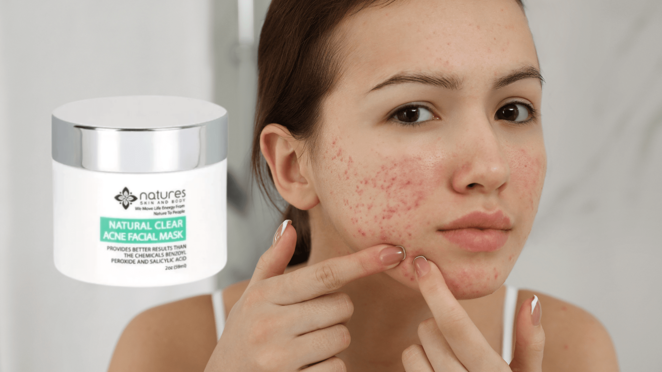What is the root cause of acne and what is the best product to keep your skin clear?