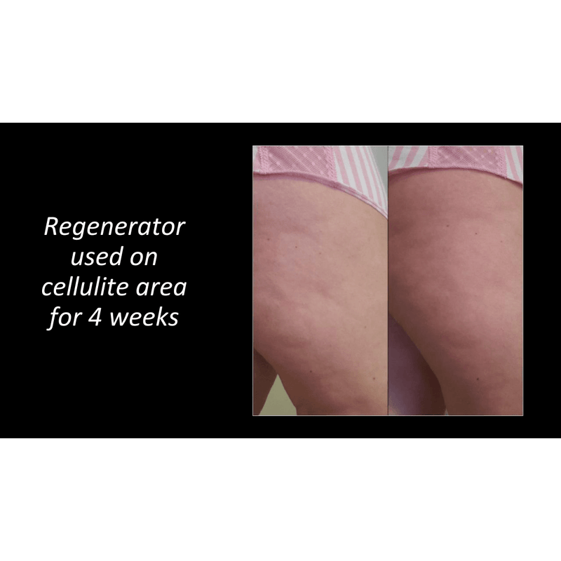 The Regenerator-Apple Cider Vinegar Cellulite Cream-Improves The Appearance Of Cellulite And Instantly Firms And Tightens Skin Anywhere Applied.