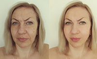 Thumbnail for Mudzyme - Anti-Aging, Resurfacing and Skin Tightening Mask.