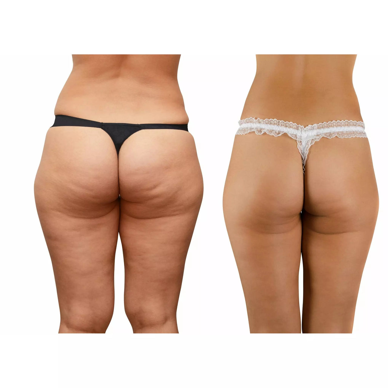 The Regenerator-Apple Cider Vinegar Cellulite Cream-Improves The Appearance Of Cellulite And Instantly Firms And Tightens Skin Anywhere Applied.